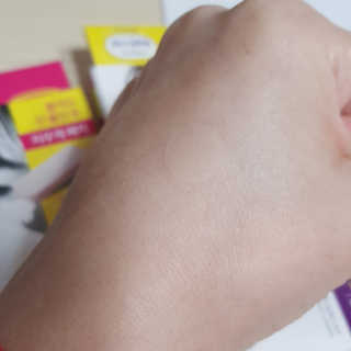 엘라밴드 하이드로 도트 스팟패치 12mm, 10mm — 5점을 준 리뷰어가 2020년 10월 올린 사용 사진