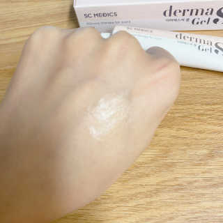 derma SC-Gel 더마에스씨 겔 20g — 4.5점을 준 리뷰어가 2020년 4월 올린 사용 사진