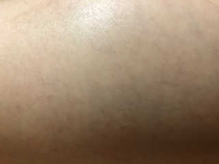 뷰티스 쎌라이트 셀룰라이트케어 바디슬리밍 PPC크림/레그젤 — 4점을 준 리뷰어가 2020년 6월 올린 사용 사진