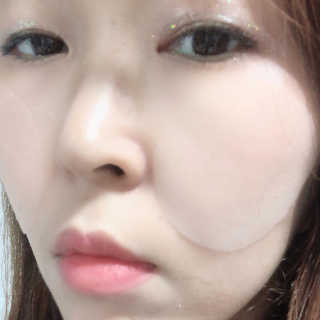 자이엘 S.O.S 레드 칙 케어팩 2 Box — 5점을 준 리뷰어가 2020년 4월 올린 사용 사진