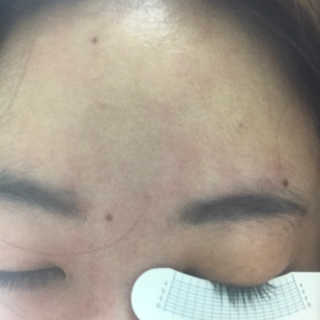 닥터존스킨 눈썹자라 — 5점을 준 리뷰어가 2020년 8월 올린 사용 사진