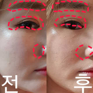 리더스코스메틱 리더스 카밍 클리어 밀크 필 클렌즈 밤 — 5점을 준 리뷰어가 2020년 7월 올린 사용 사진