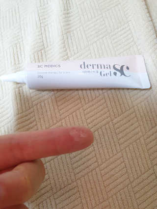 derma SC-Gel 더마에스씨 겔 20g — 4점을 준 리뷰어가 2020년 5월 올린 사용 사진