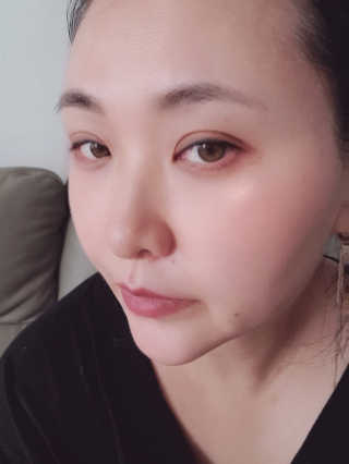 메디필 펩타이드9 아쿠아 볼륨 톡스 미스트 — 5점을 준 리뷰어가 2020년 7월 올린 사용 사진