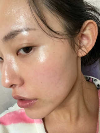 아토스탠다드 인텐시브 크림 — 4점을 준 리뷰어가 2020년 11월 올린 사용 사진