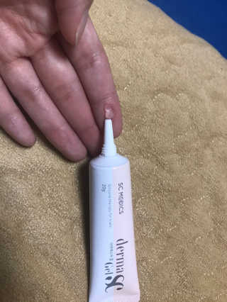 derma SC-Gel 더마에스씨 겔 20g — 5점을 준 리뷰어가 2020년 5월 올린 사용 사진