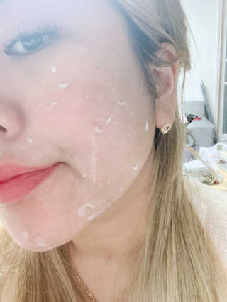 파시랩 그린 플러스 락토 버블 필링 — 5점을 준 리뷰어가 2020년 11월 올린 사용 사진