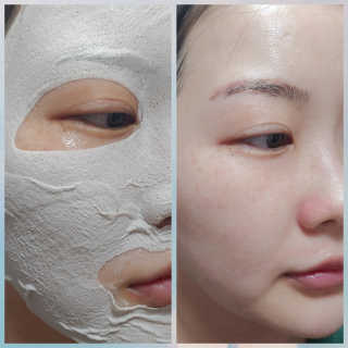 아이디플라코스메틱 페이스핏 플라스터 마스크 _ 리뉴얼 — 5점을 준 리뷰어가 2020년 11월 올린 사용 사진