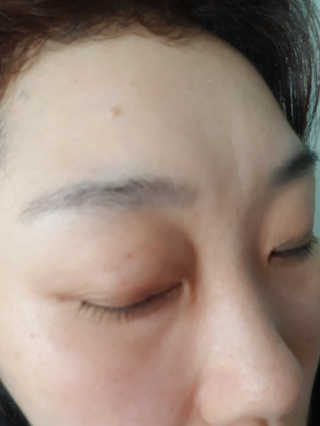 닥터존스킨 눈썹자라 — 5점을 준 리뷰어가 2020년 8월 올린 사용 사진