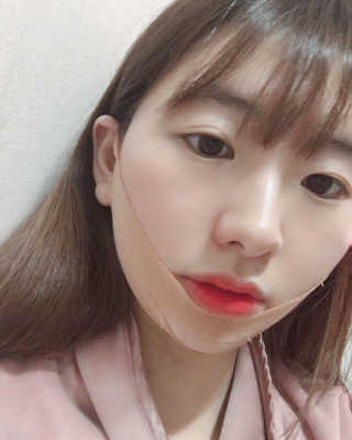 아이디플라코스메틱 아이디 페이스핏 마이너스 밴드 v2 — 2점을 준 리뷰어가 2020년 12월 올린 사용 사진