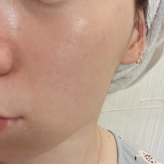 스와니코코 펩타이드 아이크림 튜브형 20ml — 4.5점을 준 리뷰어가 2020년 9월 올린 사용 사진