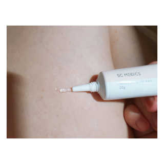 derma SC-Gel 더마에스씨 겔 20g — 5점을 준 리뷰어가 2020년 5월 올린 사용 사진