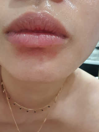 글램메디 블랙 아웃 클렌징 오일 — 5점을 준 리뷰어가 2020년 7월 올린 사용 사진