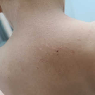 아토스탠다드 베이비크림 — 5점을 준 리뷰어가 2020년 11월 올린 사용 사진