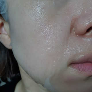 리더스코스메틱 리더스 시카 카밍  마스크 — 5점을 준 리뷰어가 2020년 5월 올린 사용 사진