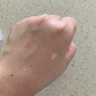 derma SC-Gel 더마에스씨 겔 20g — 5점을 준 리뷰어가 2020년 5월 올린 사용 사진