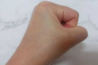 엘라밴드 하이드로 도트 스팟패치 12mm, 10mm — 5점을 준 리뷰어가 2020년 9월 올린 사용 사진