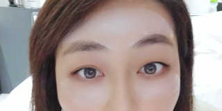 아이디플라코스메틱 아이디 페이스핏 플러스 패치 v2 — 4.5점을 준 리뷰어가 2020년 12월 올린 사용 사진