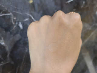 엘라밴드 하이드로 도트 스팟패치 12mm, 10mm — 5점을 준 리뷰어가 2020년 10월 올린 사용 사진