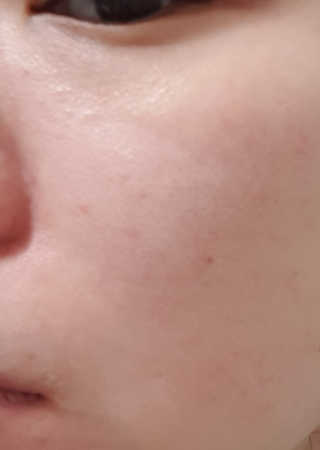미구하라 프리미엄 울트라 화이트닝 퍼펙트 앰플 오리진  20ml — 5점을 준 리뷰어가 2020년 4월 올린 사용 사진