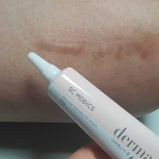 derma SC-Gel 더마에스씨 겔 20g — 5점을 준 리뷰어가 2020년 5월 올린 사용 사진