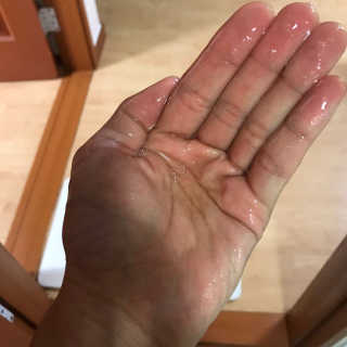 에이처드 유산균 탈모 샴푸 500ml — 5점을 준 리뷰어가 2020년 9월 올린 사용 사진