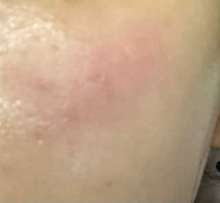 [마더메이드] 브라이트닝 퓨어 진주 마스크 10매입_K — 2.5점을 준 리뷰어가 2020년 11월 올린 사용 사진