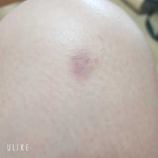 잇슈님이 올린 리뷰 사진 3