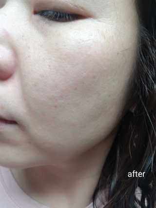 바이오믹 BIOMEEK SENSIMETIC MILD ACID CLEANSER — 5점을 준 리뷰어가 2020년 7월 올린 사용 사진