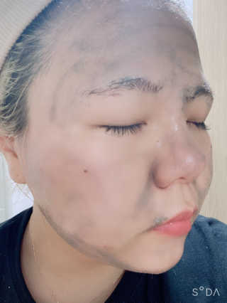 더말로지카 데일리 슈퍼폴리언트 — 4점을 준 리뷰어가 2020년 6월 올린 사용 사진