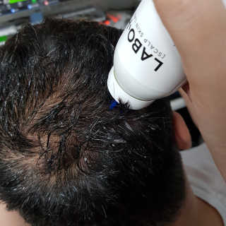 라보에이치 탈모증상완화 토닉 두피쿨링 — 4점을 준 리뷰어가 2020년 9월 올린 사용 사진