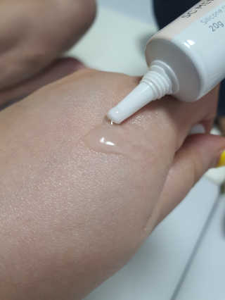 derma SC-Gel 더마에스씨 겔 20g — 5점을 준 리뷰어가 2020년 4월 올린 사용 사진