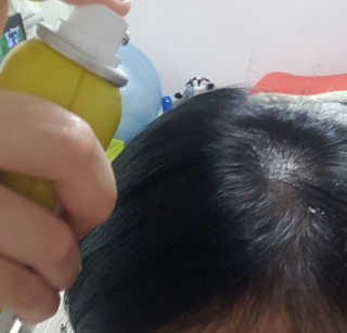 달리프 클로렐라 베러 루트 쿨링 스프레이 100ml — 5점을 준 리뷰어가 2020년 8월 올린 사용 사진