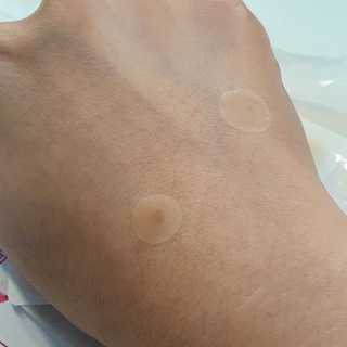 엘라밴드 하이드로 도트 스팟패치 12mm, 10mm — 5점을 준 리뷰어가 2020년 10월 올린 사용 사진