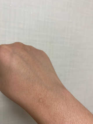 derma SC-Gel 더마에스씨 겔 20g — 5점을 준 리뷰어가 2020년 4월 올린 사용 사진