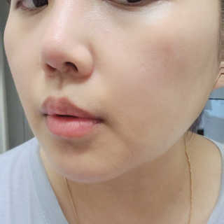 메디필 블루 아쿠아 톡스 크림 — 5점을 준 리뷰어가 2020년 6월 올린 사용 사진