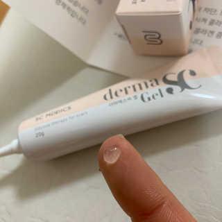 derma SC-Gel 더마에스씨 겔 20g — 4.5점을 준 리뷰어가 2020년 4월 올린 사용 사진