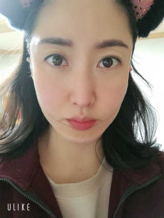 아이디플라코스메틱 아이디 페이스핏 마이너스 밴드 v2 — 5점을 준 리뷰어가 2020년 12월 올린 사용 사진