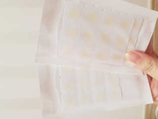 엘라밴드 하이드로 도트 스팟패치 12mm, 10mm — 5점을 준 리뷰어가 2020년 9월 올린 사용 사진