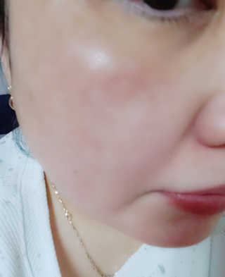 charming_skin님이 올린 리뷰 사진 4
