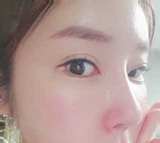 바베 BABE 바베 프로테오글리칸 F+F 앰플 솔루션 — 5점을 준 리뷰어가 2020년 9월 올린 사용 사진