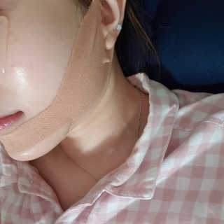 아이디플라코스메틱 아이디 페이스핏 마이너스 밴드 — 5점을 준 리뷰어가 2020년 4월 올린 사용 사진