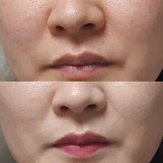 세렌디뷰티 레드 프로폴리스 하이 커버링 트리플 쿠션 — 5점을 준 리뷰어가 2020년 8월 올린 사용 사진