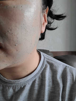 천사연구소 진짜 生병풀잎을 그대로  갈아 넣은 워시오프 센텔라팩 — 5점을 준 리뷰어가 2020년 7월 올린 사용 사진
