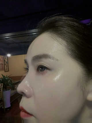 아토스탠다드 베이비크림 — 5점을 준 리뷰어가 2020년 11월 올린 사용 사진