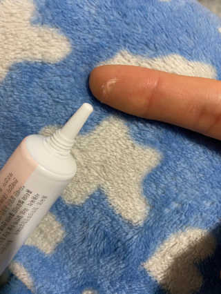 derma SC-Gel 더마에스씨 겔 20g — 5점을 준 리뷰어가 2020년 5월 올린 사용 사진