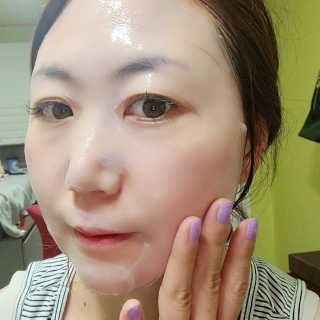 이너풀 하이 모이스처라이징 바이오셀룰로오스 마스크 — 5점을 준 리뷰어가 2020년 7월 올린 사용 사진
