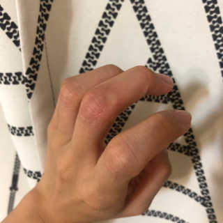 짜이디 야몽_허브로만든 힐링 아로마오일 — 5점을 준 리뷰어가 2020년 10월 올린 사용 사진