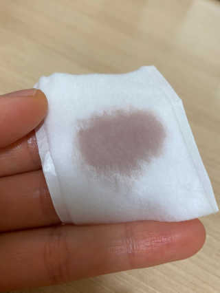 메디필 블랙 허니 세범 익스트렉터 — 5점을 준 리뷰어가 2020년 6월 올린 사용 사진
