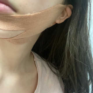 아이디플라코스메틱 아이디 페이스핏 마이너스 밴드 v2 — 4점을 준 리뷰어가 2020년 12월 올린 사용 사진